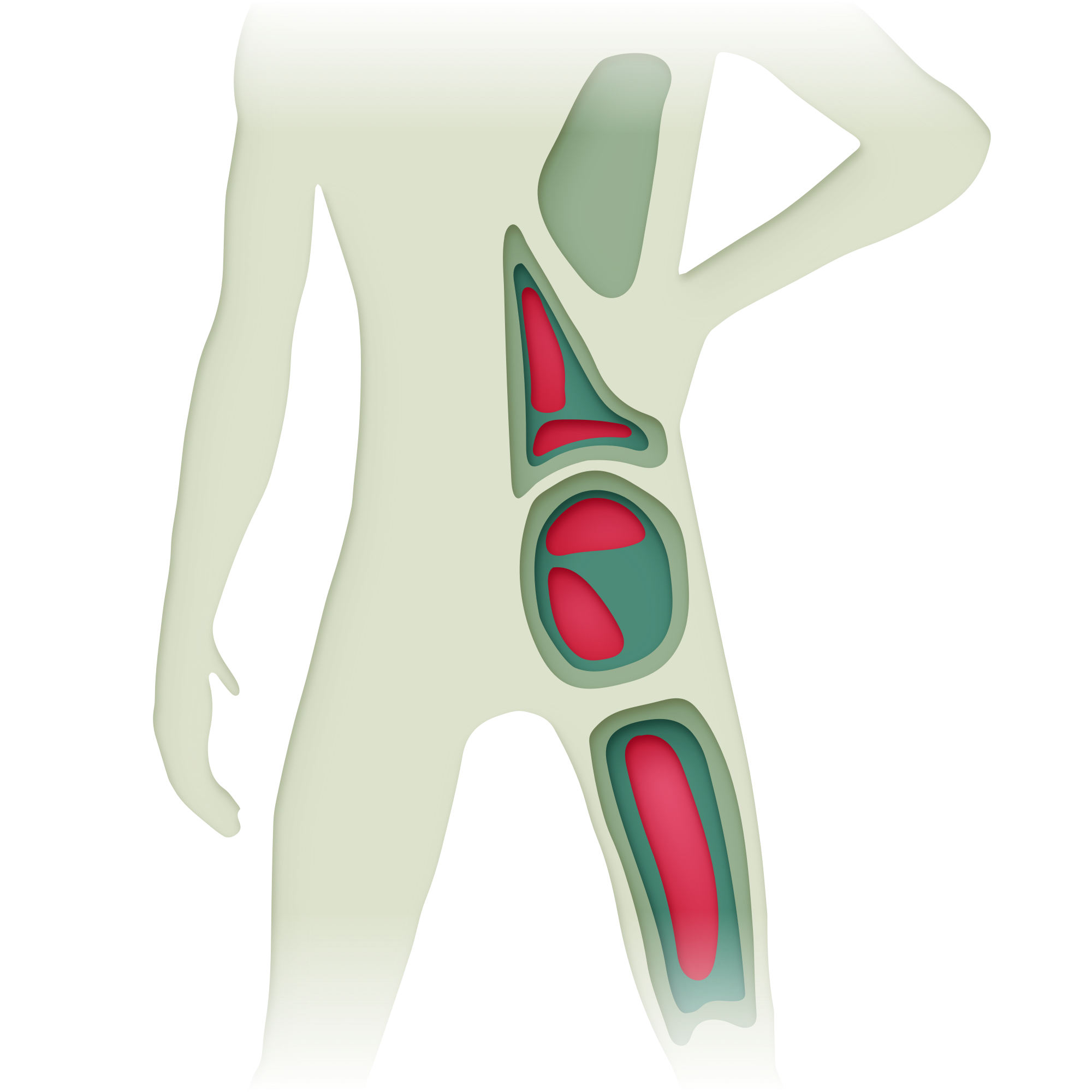 Lower back pain points