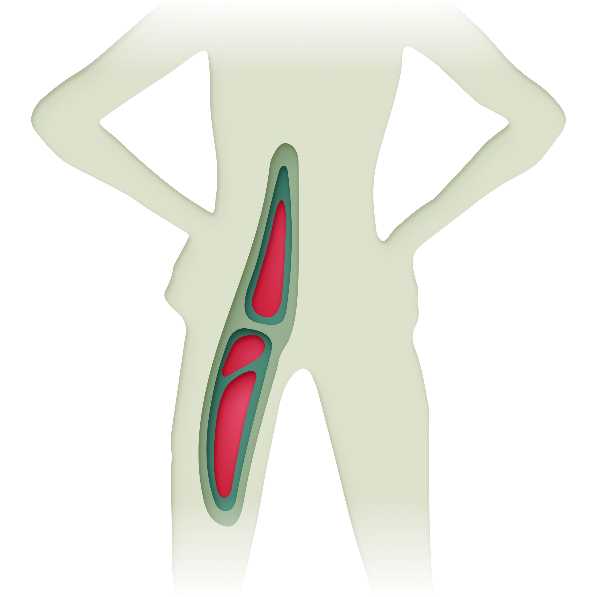 Sciatica pain points